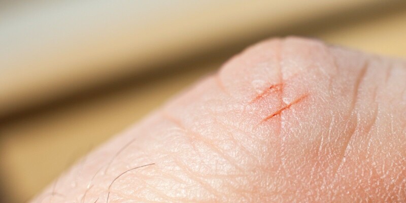 Print management outfit PaperCut is under 0-day attack, and it’s drawing customers’ blood